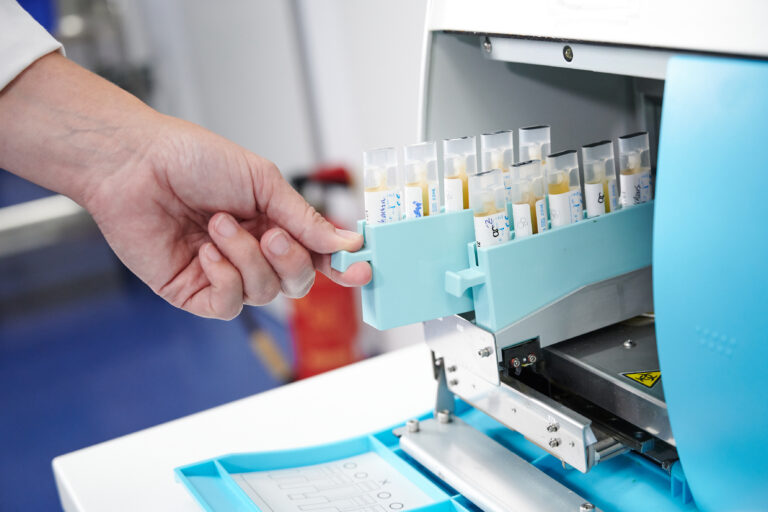 Probenröhrchen werden für eine schnelle Laboranalyse vorbereitet. Bild steht für zeitnahe Diagnostik und Effizienz.